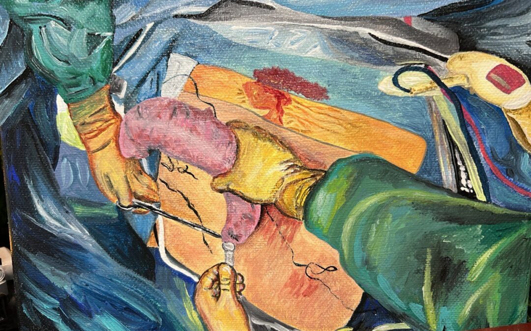 Comprendre la sleeve gastrectomie  avec une vidéo explicative