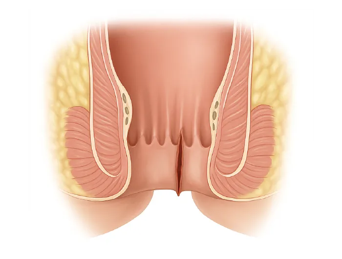 fissure anale schema igea