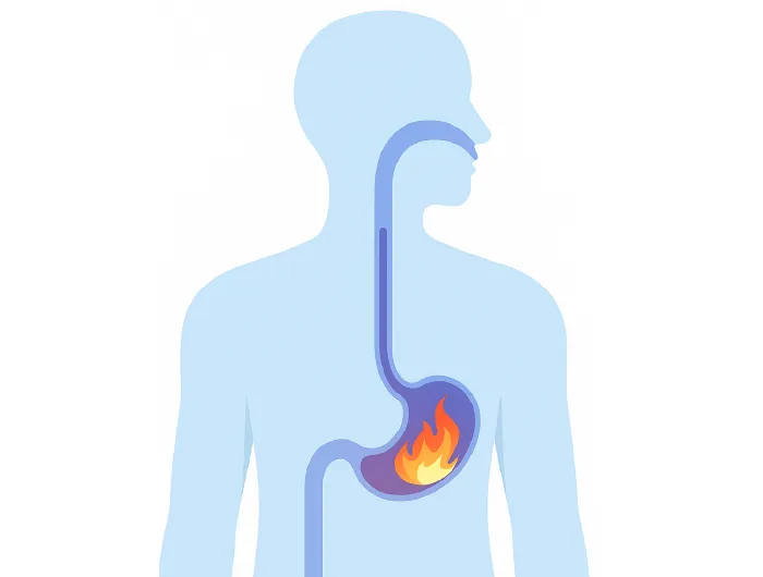 reflux gastro œsophagien infographie brulure d'estomac