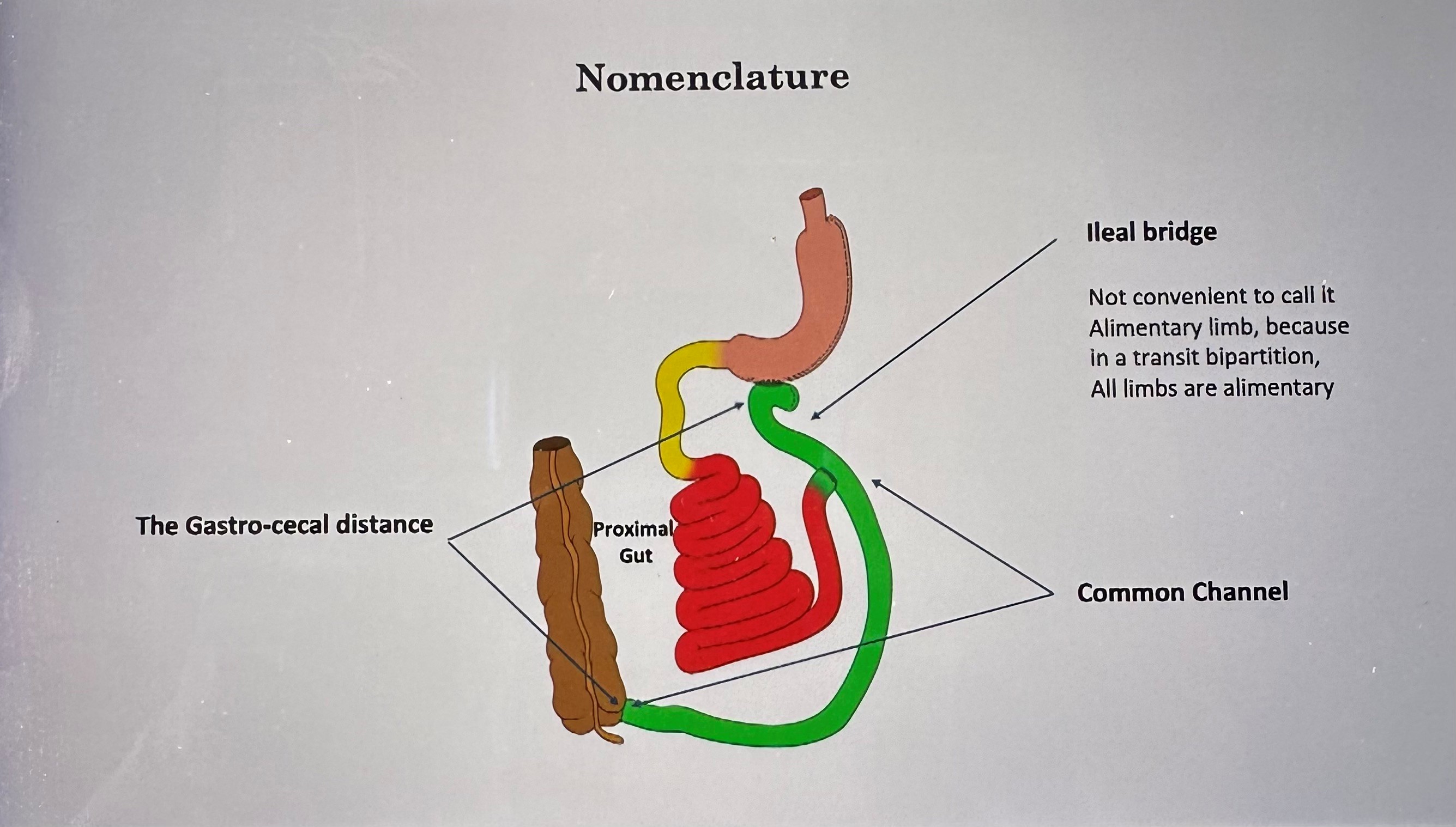 Nomenclature Sleeve, Anastomose
